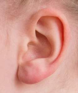 Anatomy 101: Understanding the Pinna as the Visible Part of the Outer Ear
